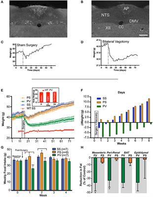 Subdiaphragmatic Vagotomy With Pyloroplasty Ameliorates the Obesity Caused by Genetic Deletion of the Melanocortin 4 Receptor in the Mouse